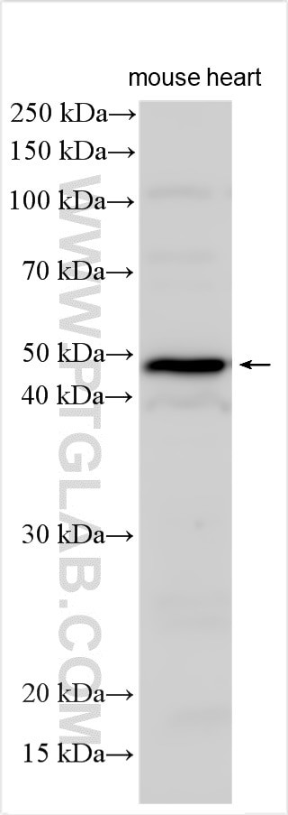 TBC1D13 Antibody in Western Blot (WB)