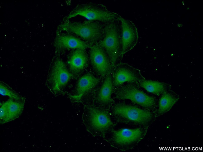 MYO10 Antibody in Immunocytochemistry (ICC/IF)
