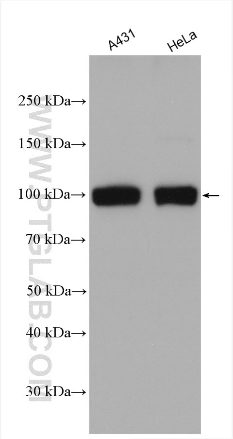 SUN1 Antibody in Western Blot (WB)