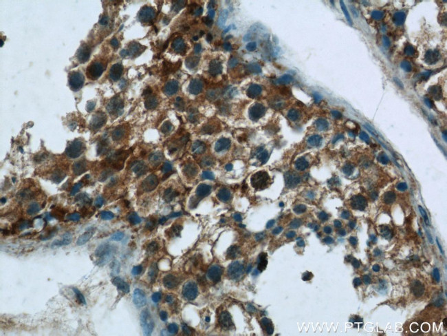 LRRC18 Antibody in Immunohistochemistry (Paraffin) (IHC (P))