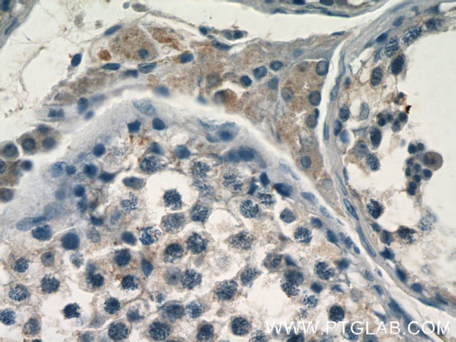 FAM133A Antibody in Immunohistochemistry (Paraffin) (IHC (P))