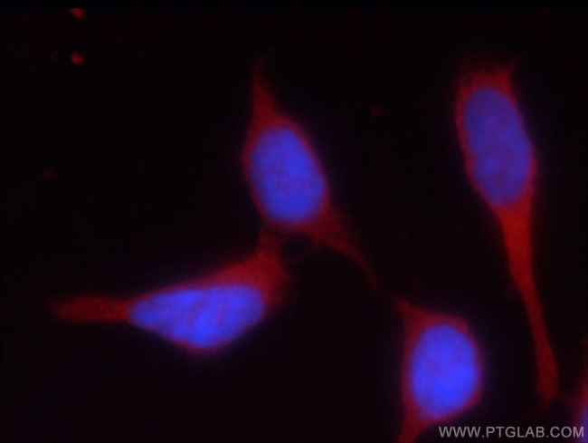 HEATR2 Antibody in Immunocytochemistry (ICC/IF)