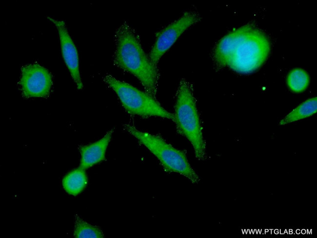 SLC37A1 Antibody in Immunocytochemistry (ICC/IF)