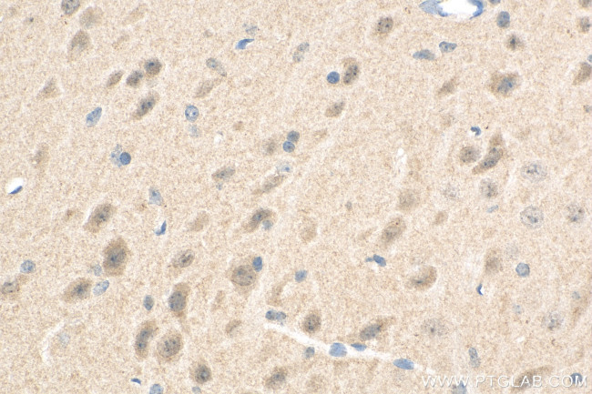 PDZ-GEF2 Antibody in Immunohistochemistry (Paraffin) (IHC (P))