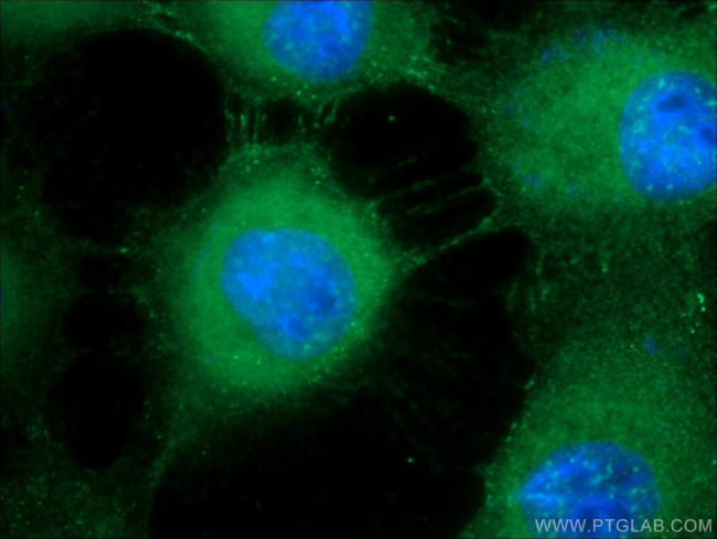 DSG1 Antibody in Immunocytochemistry (ICC/IF)