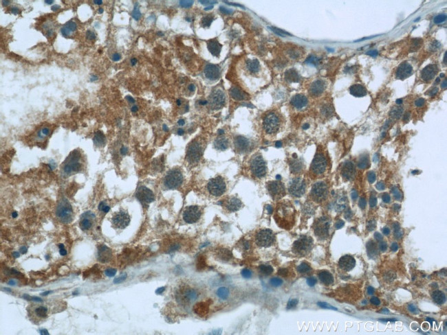 CEP85L Antibody in Immunohistochemistry (Paraffin) (IHC (P))