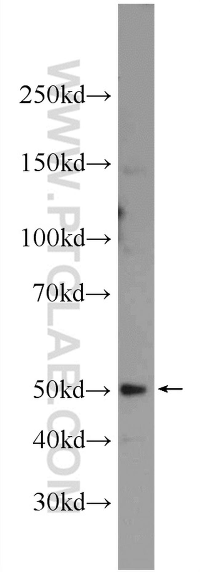 SEPT14 Antibody in Western Blot (WB)