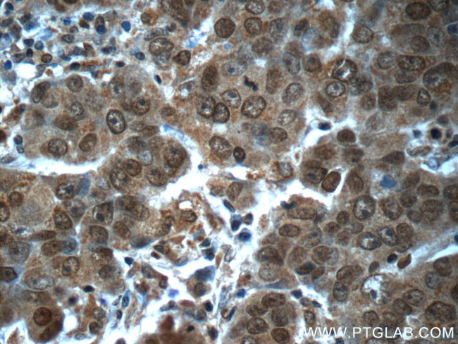 POTEA Antibody in Immunohistochemistry (Paraffin) (IHC (P))