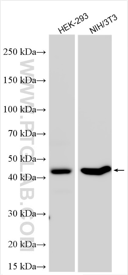 CLN5 Antibody in Western Blot (WB)