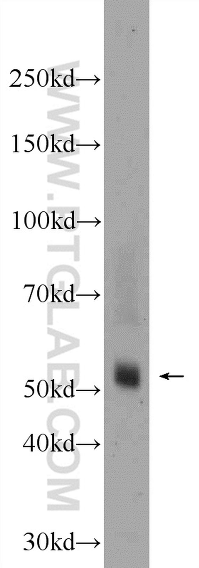 TMPRSS5 Antibody in Western Blot (WB)