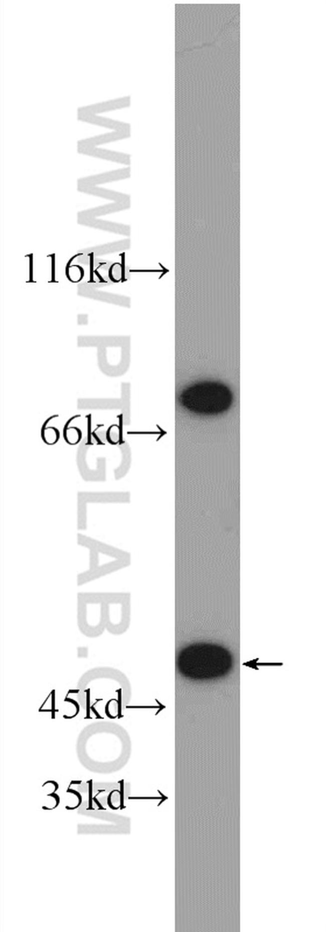 RNF167 Antibody in Western Blot (WB)