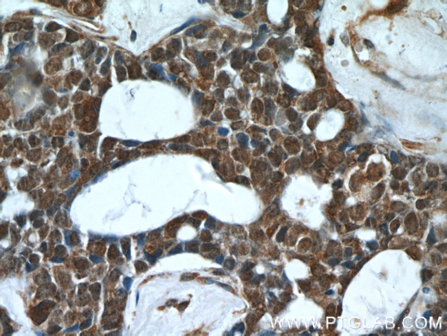 PHF2 Antibody in Immunohistochemistry (Paraffin) (IHC (P))