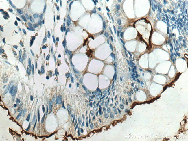 CEACAM7 Antibody in Immunohistochemistry (Paraffin) (IHC (P))