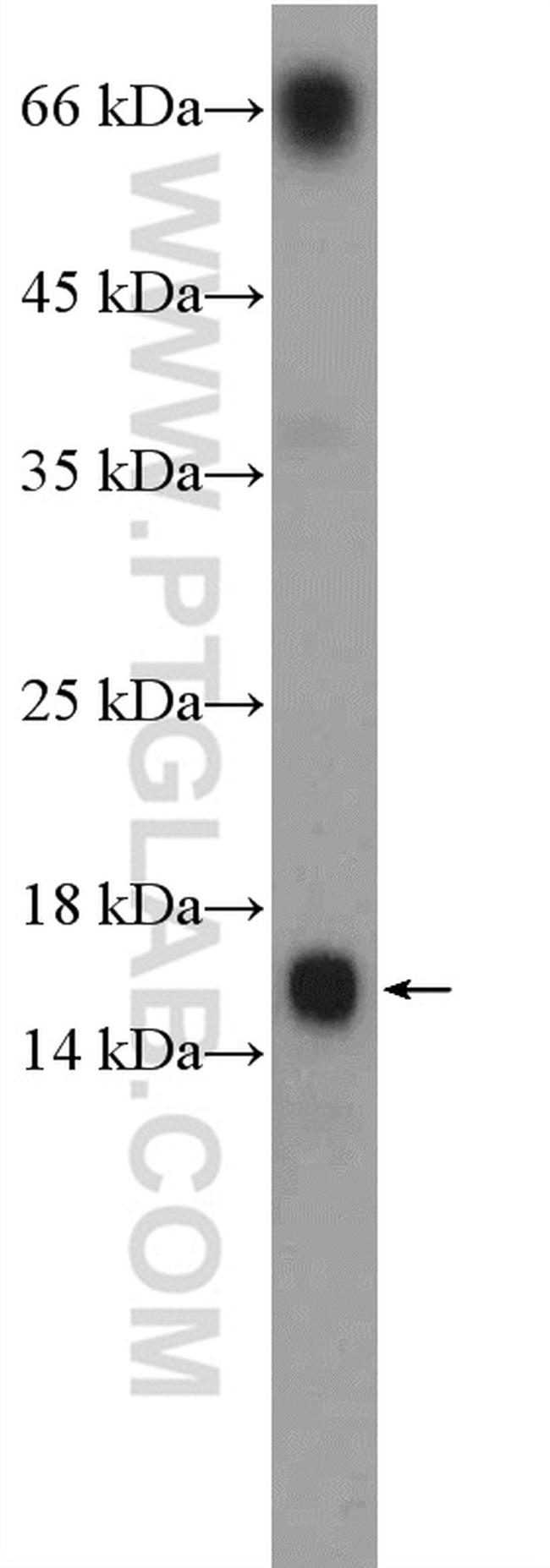 LY6G5C Antibody in Western Blot (WB)