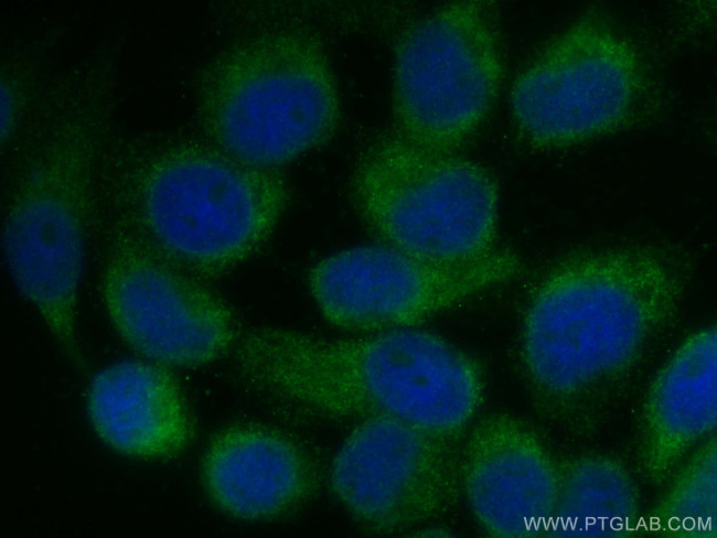 TMEM111 Antibody in Immunocytochemistry (ICC/IF)