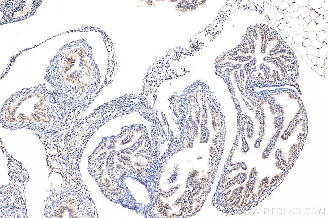 SPRR2F Antibody in Immunohistochemistry (Paraffin) (IHC (P))