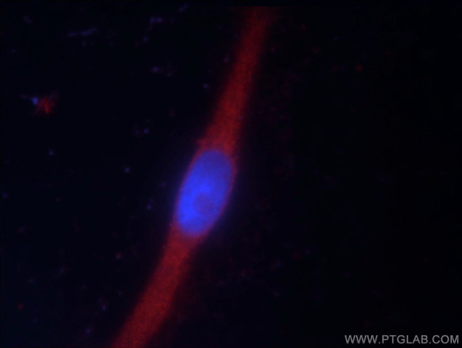 LRSAM1 Antibody in Immunocytochemistry (ICC/IF)