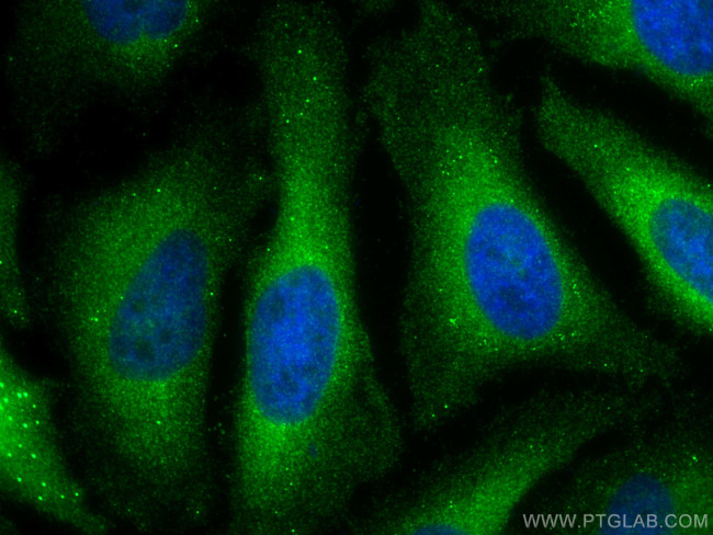 TBC1D4 Antibody in Immunocytochemistry (ICC/IF)
