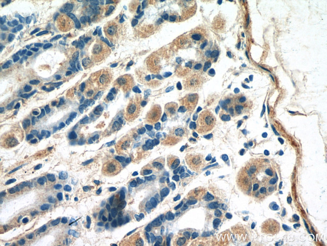 B4GALNT3 Antibody in Immunohistochemistry (Paraffin) (IHC (P))