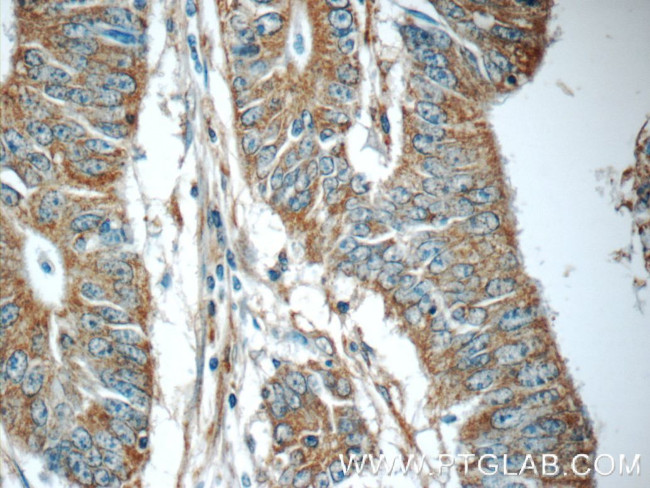C20orf46 Antibody in Immunohistochemistry (Paraffin) (IHC (P))