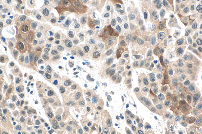 SPRR1A Antibody in Immunohistochemistry (Paraffin) (IHC (P))