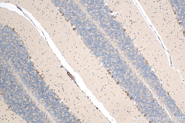 AMMECR1 Antibody in Immunohistochemistry (Paraffin) (IHC (P))