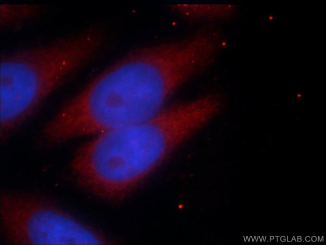 PRY Antibody in Immunocytochemistry (ICC/IF)