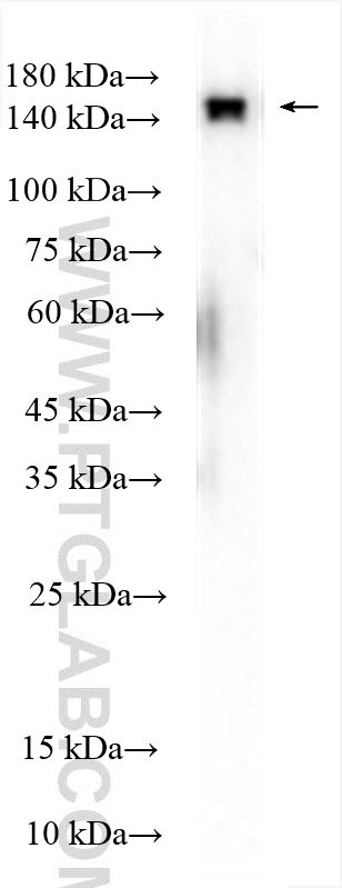 KIF7 Antibody in Western Blot (WB)