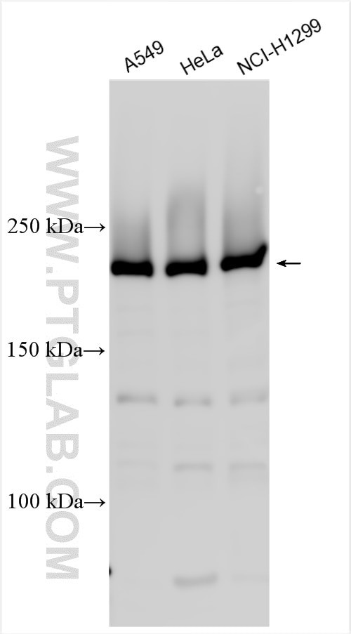 KNTC1 Antibody in Western Blot (WB)