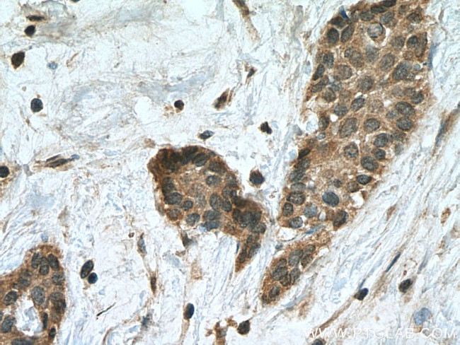 HECW1 Antibody in Immunohistochemistry (Paraffin) (IHC (P))