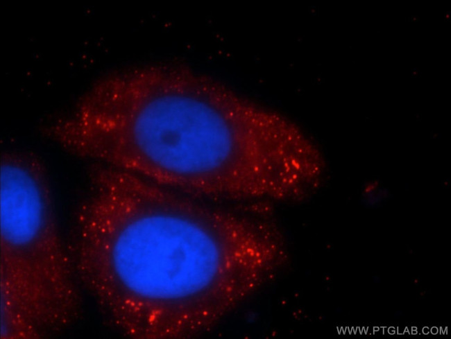 C5orf26 Antibody in Immunocytochemistry (ICC/IF)