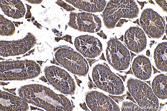 RNF151 Antibody in Immunohistochemistry (Paraffin) (IHC (P))