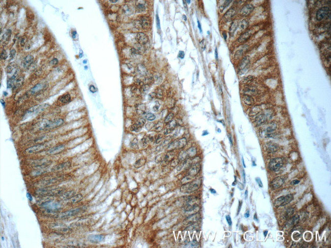 BEND4 Antibody in Immunohistochemistry (Paraffin) (IHC (P))