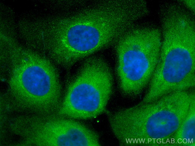 PFAS Antibody in Immunocytochemistry (ICC/IF)