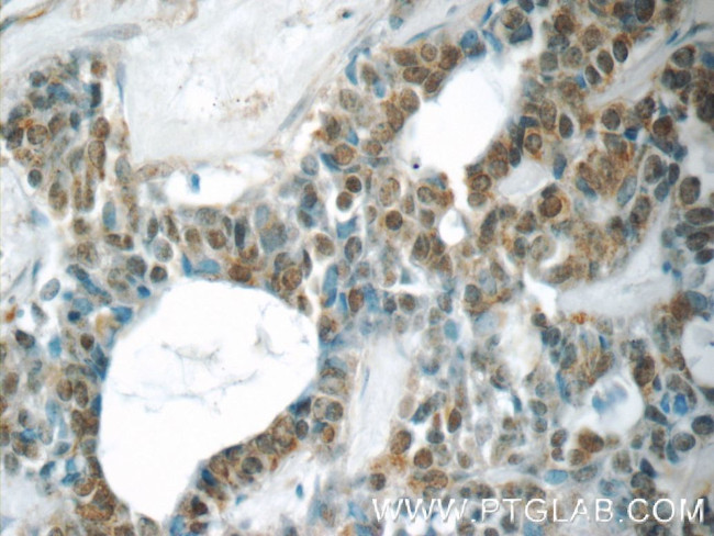 YEATS2 Antibody in Immunohistochemistry (Paraffin) (IHC (P))