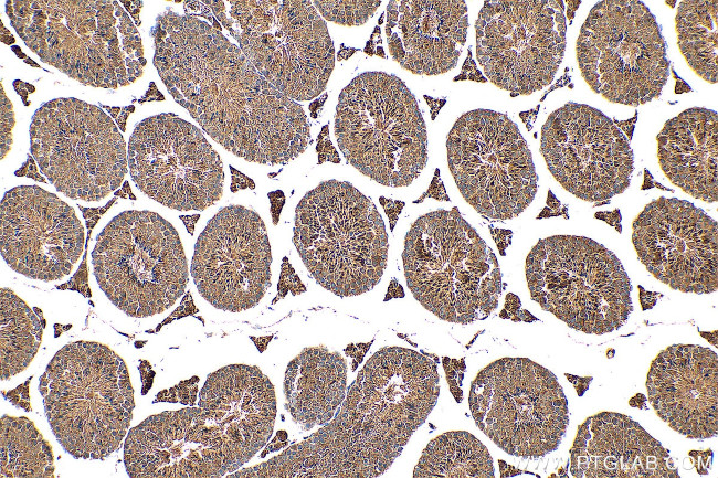C14orf138 Antibody in Immunohistochemistry (Paraffin) (IHC (P))