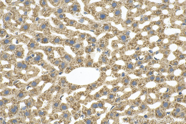 CARD10 Antibody in Immunohistochemistry (Paraffin) (IHC (P))