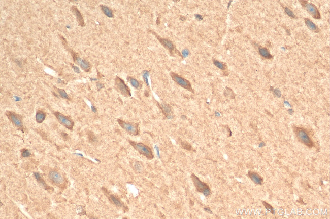 TRPC1 Antibody in Immunohistochemistry (Paraffin) (IHC (P))