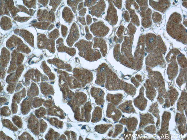 ILVBL Antibody in Immunohistochemistry (Paraffin) (IHC (P))