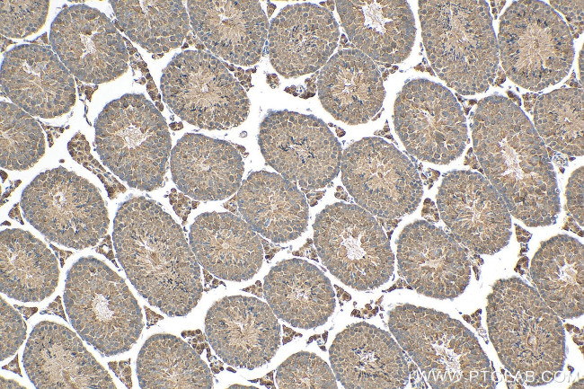 FAM8A1 Antibody in Immunohistochemistry (Paraffin) (IHC (P))