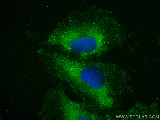 ZNF573 Antibody in Immunocytochemistry (ICC/IF)