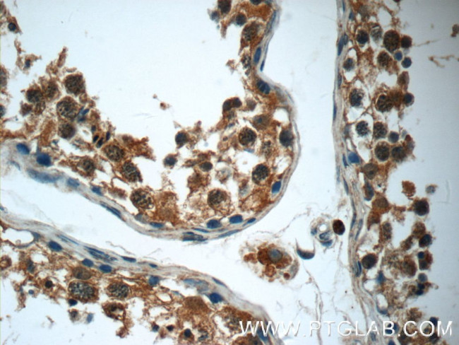 RPS6KL1 Antibody in Immunohistochemistry (Paraffin) (IHC (P))
