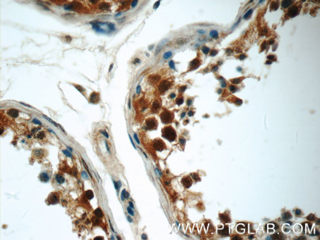 MUM1L1 Antibody in Immunohistochemistry (Paraffin) (IHC (P))