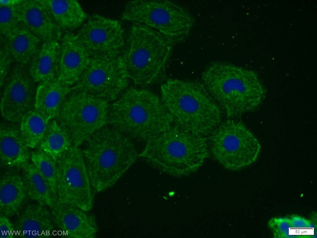 TOR1AIP2 Antibody in Immunocytochemistry (ICC/IF)