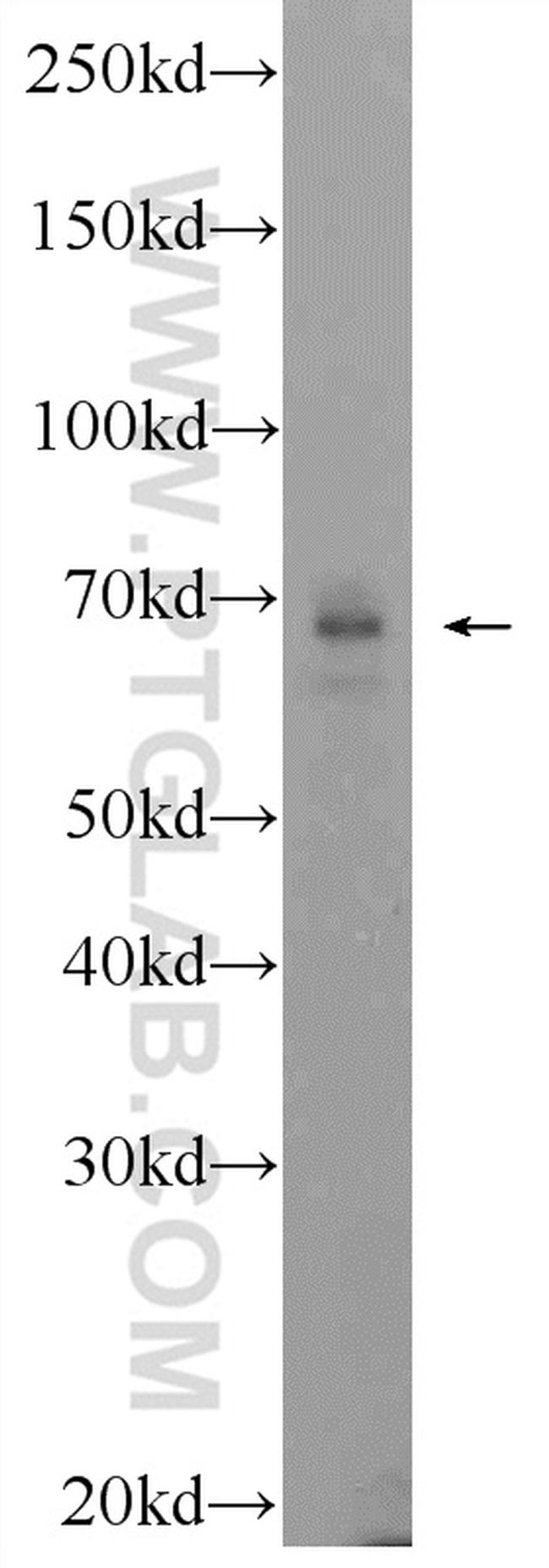 SCC4 Antibody in Western Blot (WB)