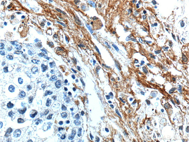 EMILIN2 Antibody in Immunohistochemistry (Paraffin) (IHC (P))