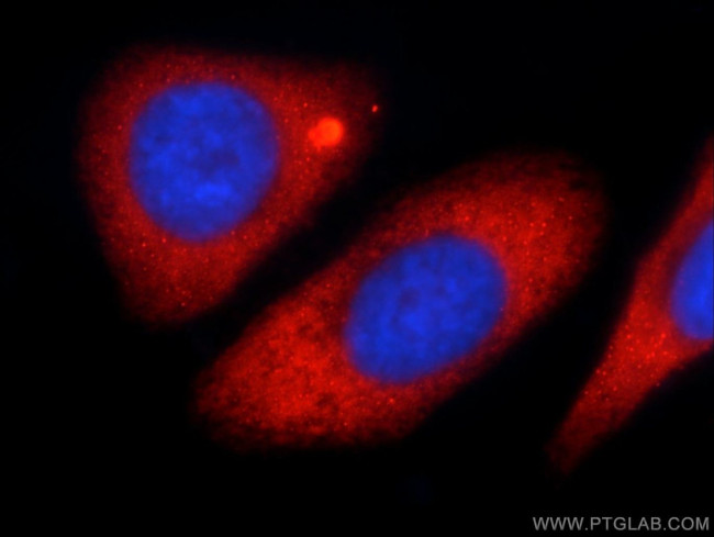 KLHL31 Antibody in Immunocytochemistry (ICC/IF)