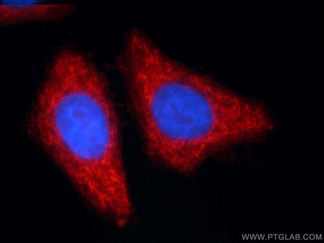 ANKS1B Antibody in Immunocytochemistry (ICC/IF)