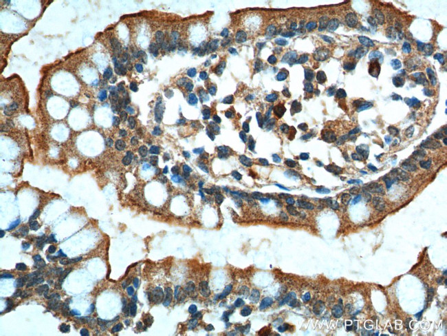 GPR128 Antibody in Immunohistochemistry (Paraffin) (IHC (P))
