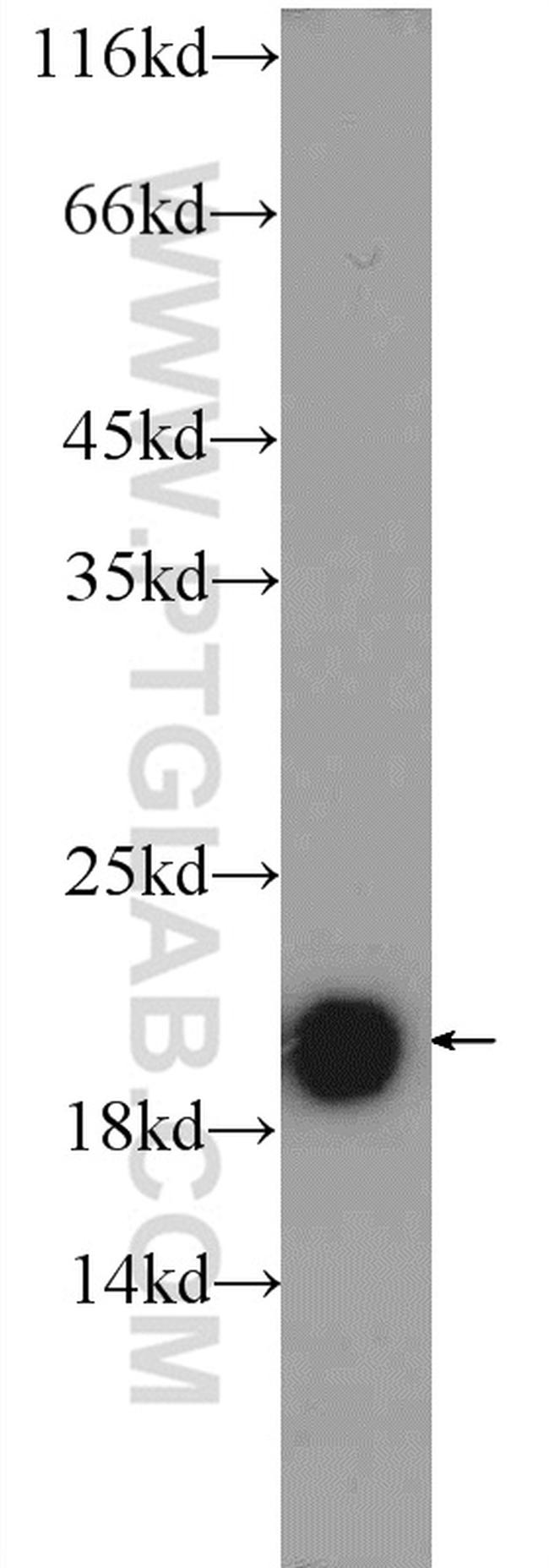 TMEM35 Antibody in Western Blot (WB)